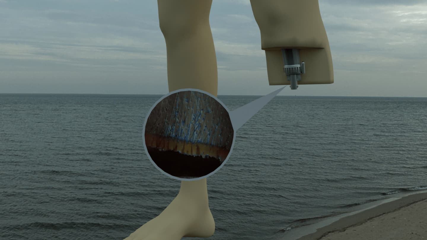 prosthetic